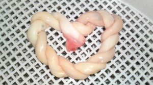 Picture of Cord cut 20-60 mins after birth