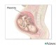 placenta-picture-d-300x240